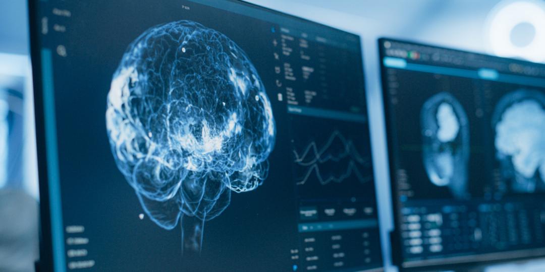 Voici les habitudes simples qui pourraient rendre votre cerveau jusqu'à ...