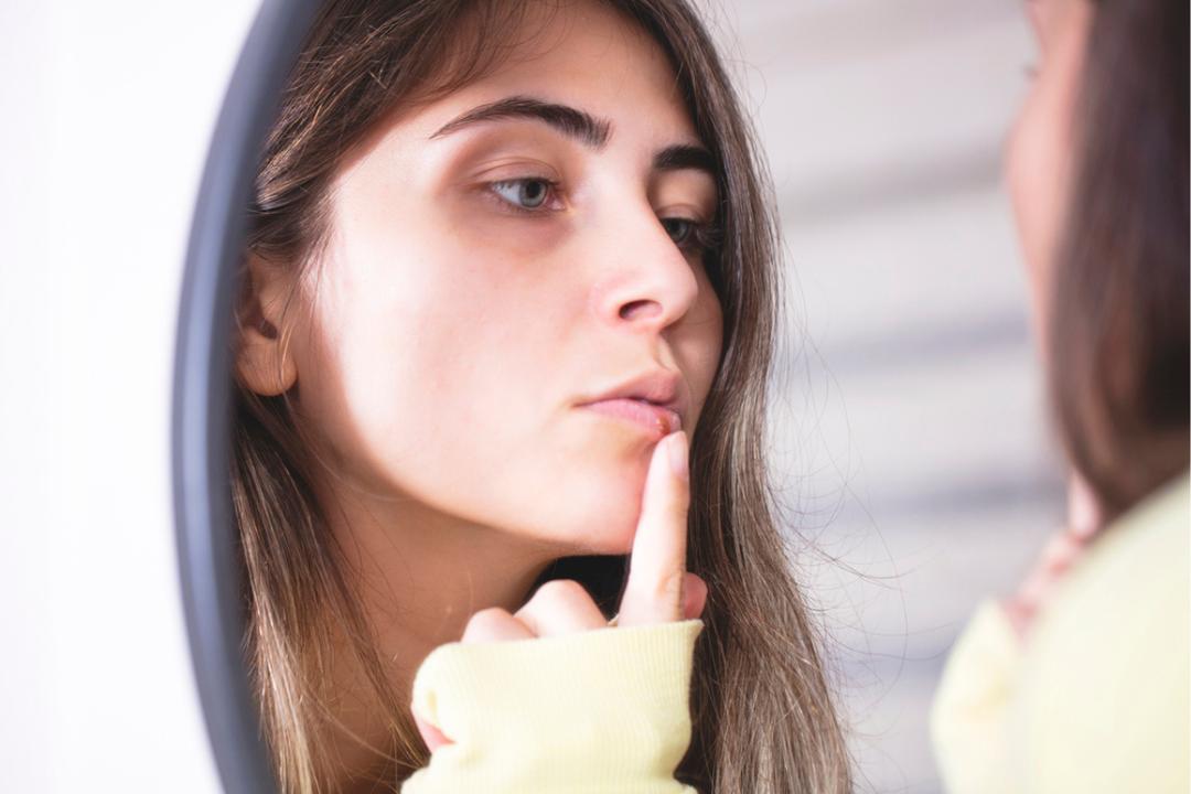 90 % des adultes portent ce virus : ce qui déclenche vraiment les boutons de fièvre