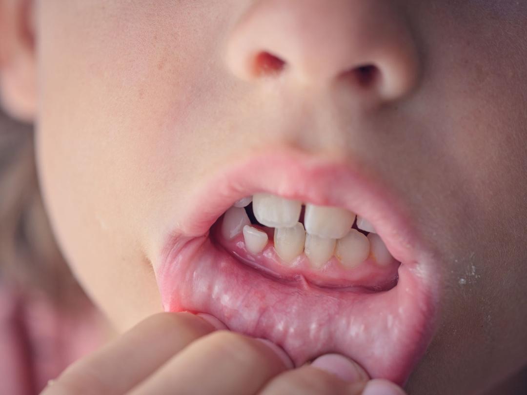 Les vapoteuses font autant de dgts dans l'ADN que les cigarettes classiques Les vapoteuses font autant de dgts dans l'ADN que les cigarettes classiques