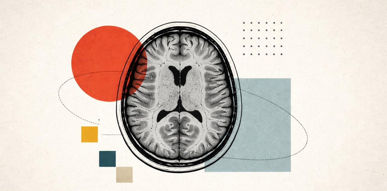 Une IA réussit à lire seule le cerveau et à prédire les maladies et le taux de survie au cancer sans annotation des médecins