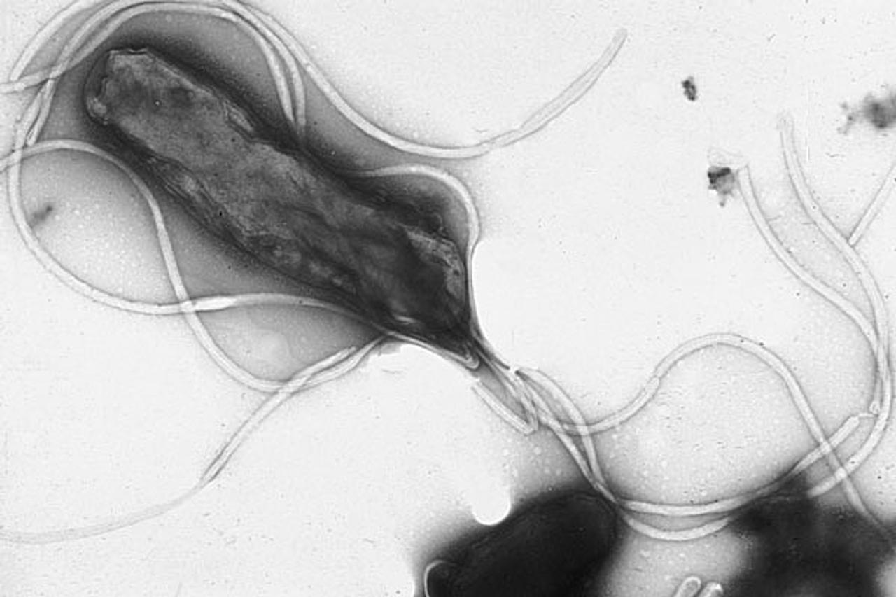 Helicobacter pylori&amp;nbsp;est la seule bactérie connue capable de survivre dans un milieu aussi acide que celui de l&#39;estomac. Très fréquente dans l&#39;espèce humaine, elle limiterait les risques d&#39;apparition de l&#39;obésité et du diabète souvent associé.&amp;nbsp;© Yutaka Tsutstumi, Wikipédia, DP