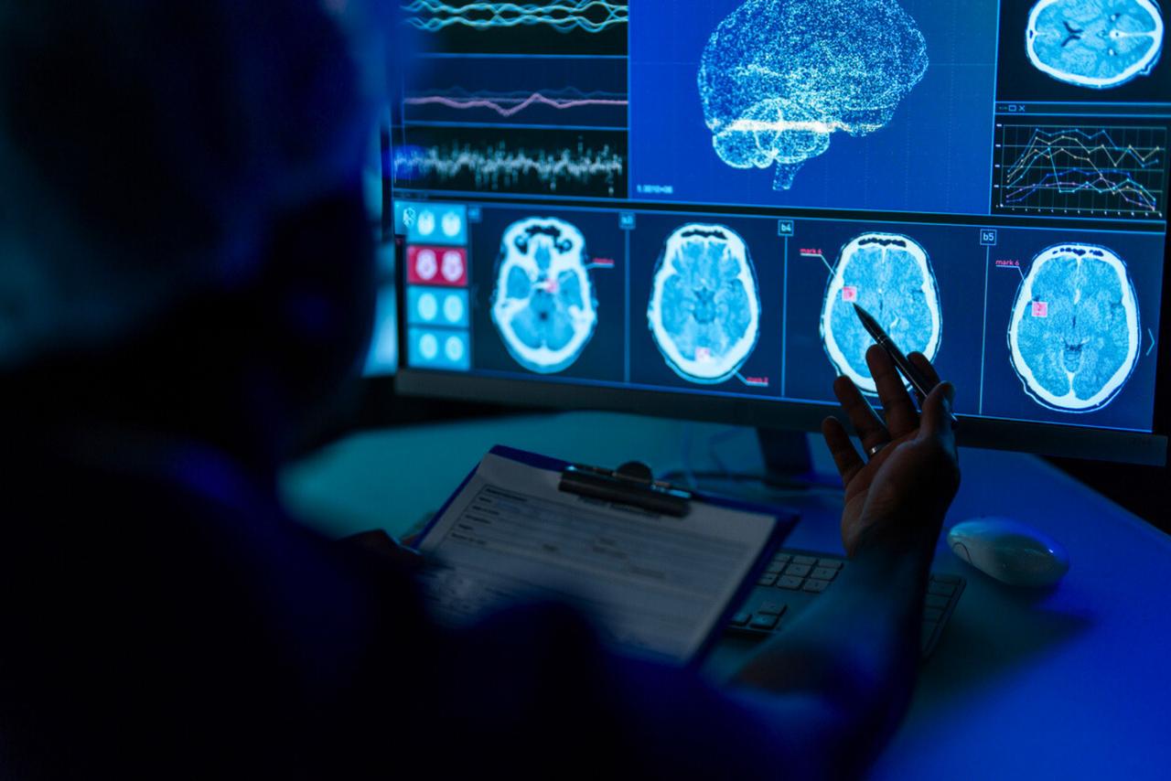 Cette anomalie dans le cerveau pourrait faire le lien entre TDAH et Alzheimer