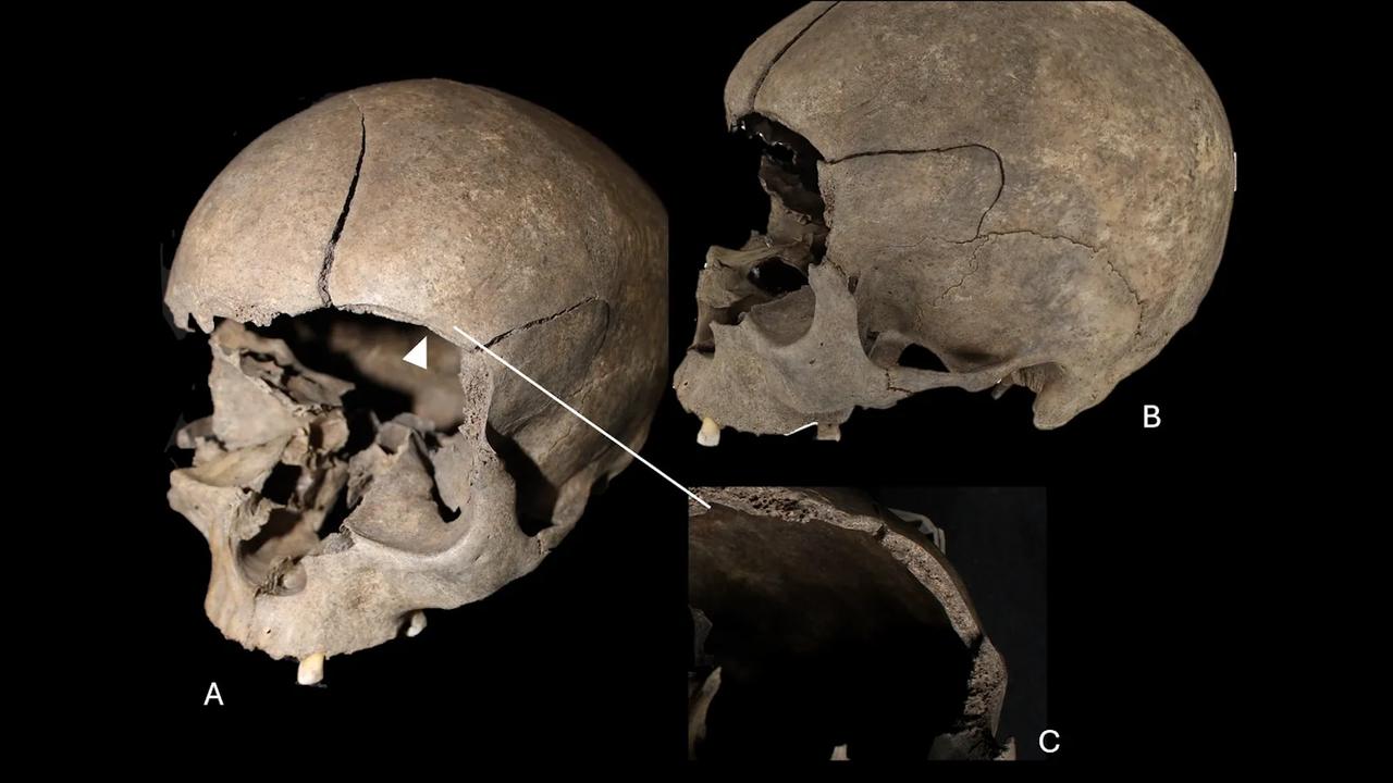 « Ils marchaient sur le crâne d'un enfant » : la découverte glaçante qui éclaire la Scandinavie avant et pendant les Vikings