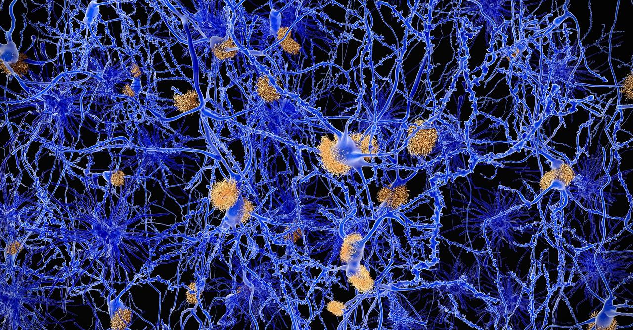 Maladies à prions : les biologistes accusent de nouveau le cuivre