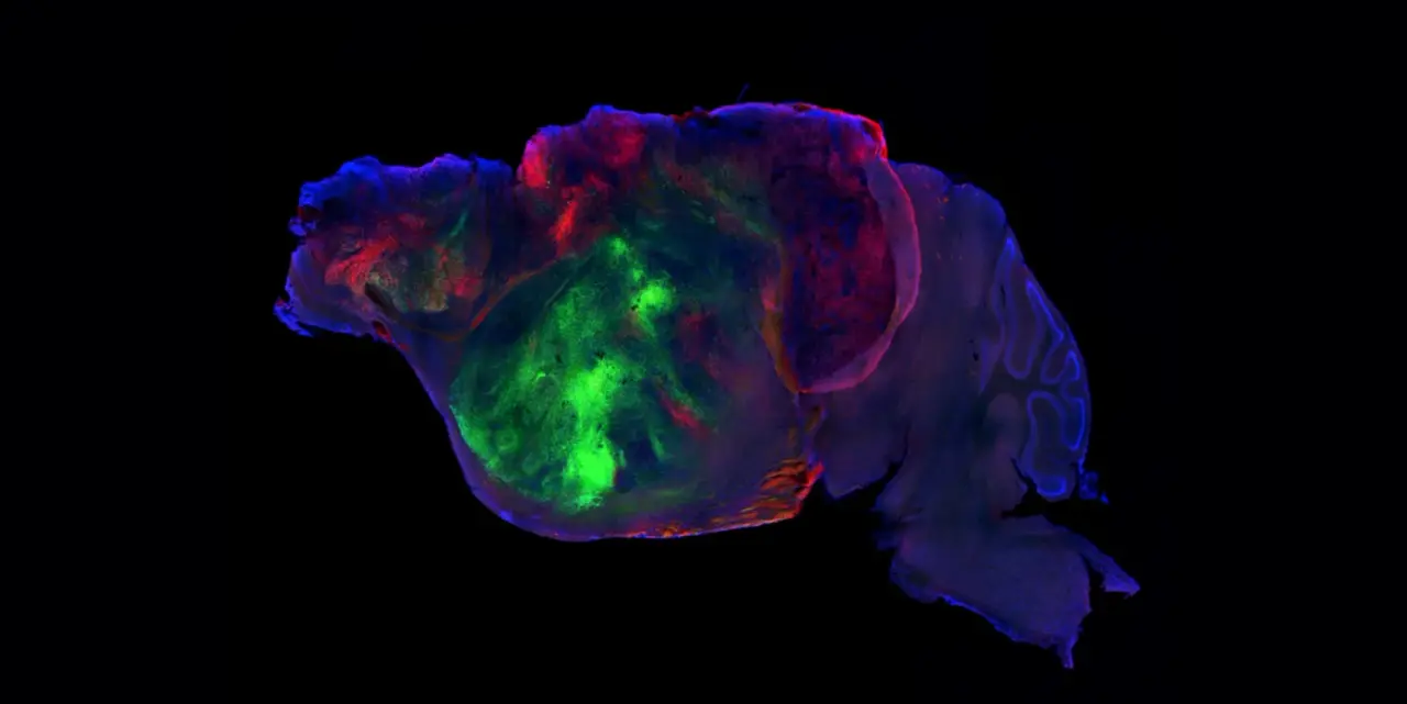 Des chercheurs ont connecté du tissu humain dans le cerveau de souris : ce qui s’est produit ensuite est inédit !