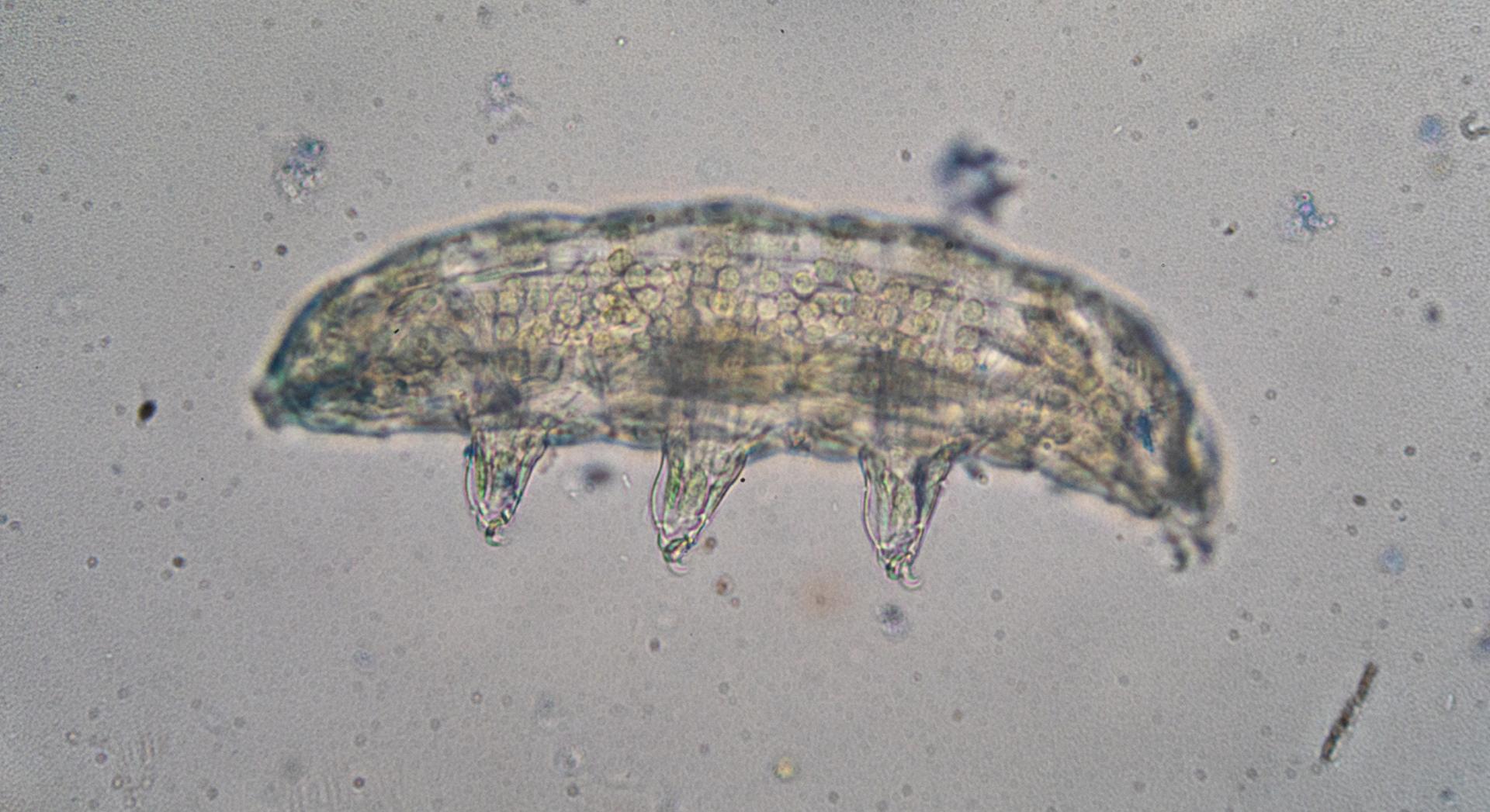 Une seule protéine de tardigrade suffirait à réduire les dommages des radiations sur les cellules humaines : voici comment