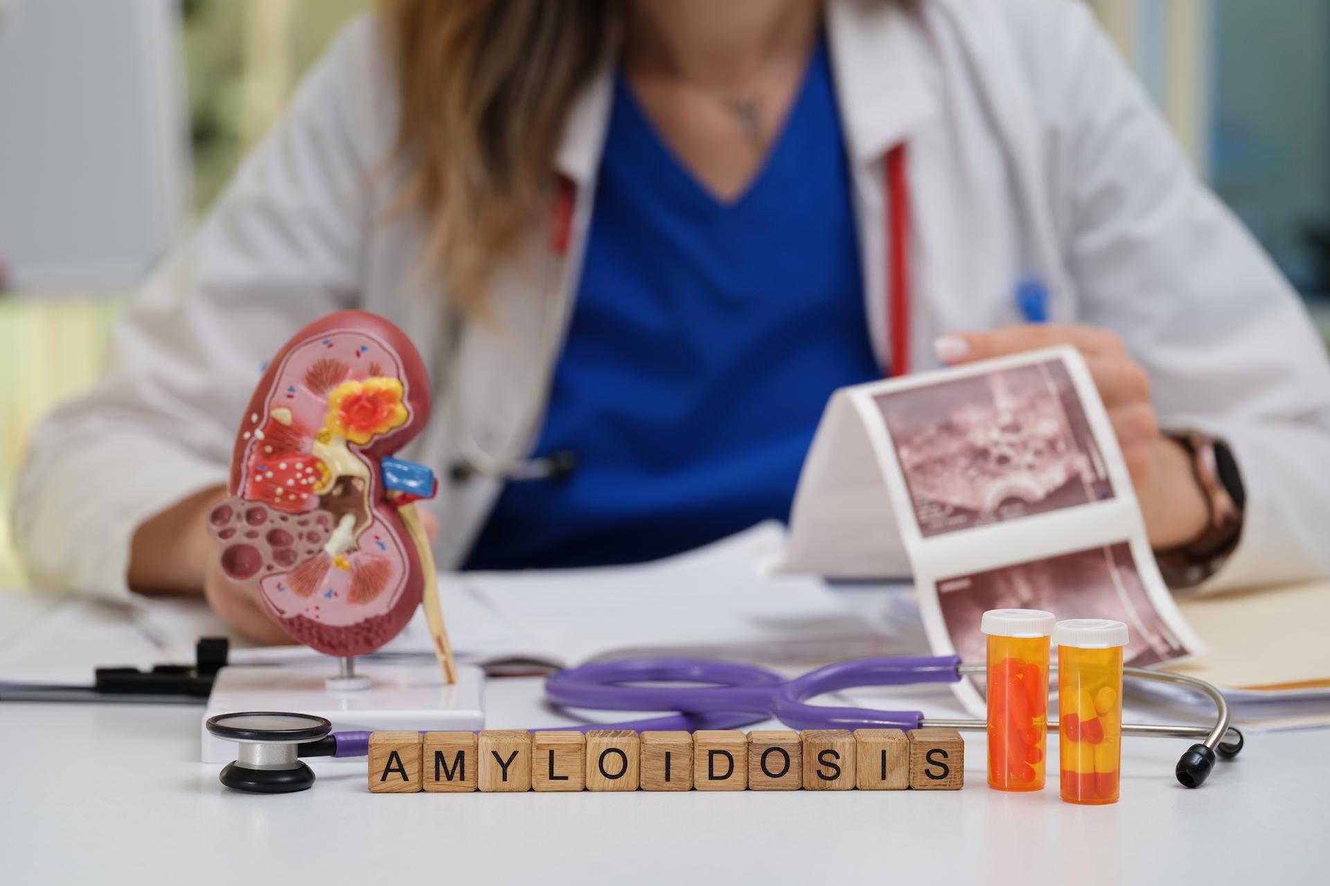 L’ARN interférent (ARNi) : une avancée thérapeutique majeure contre l’amylose !