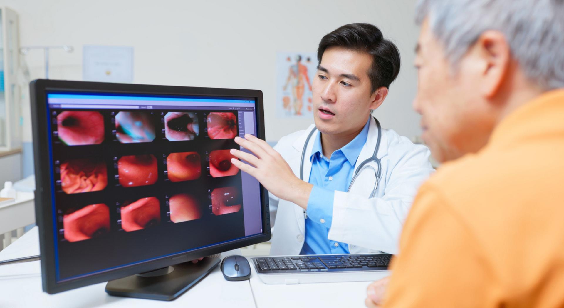 Cancer de l'estomac : les scientifiques alertent sur une bactérie très répandue mais souvent ignorée