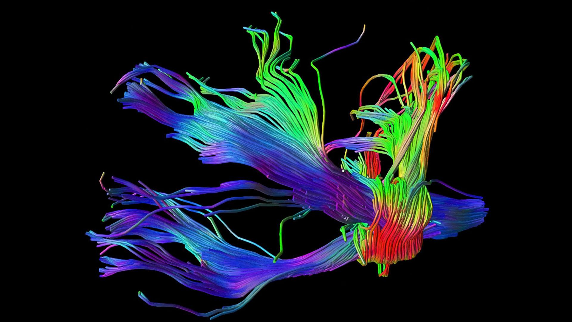 Le cerveau en 13 images méconnues et pourtant incroyables