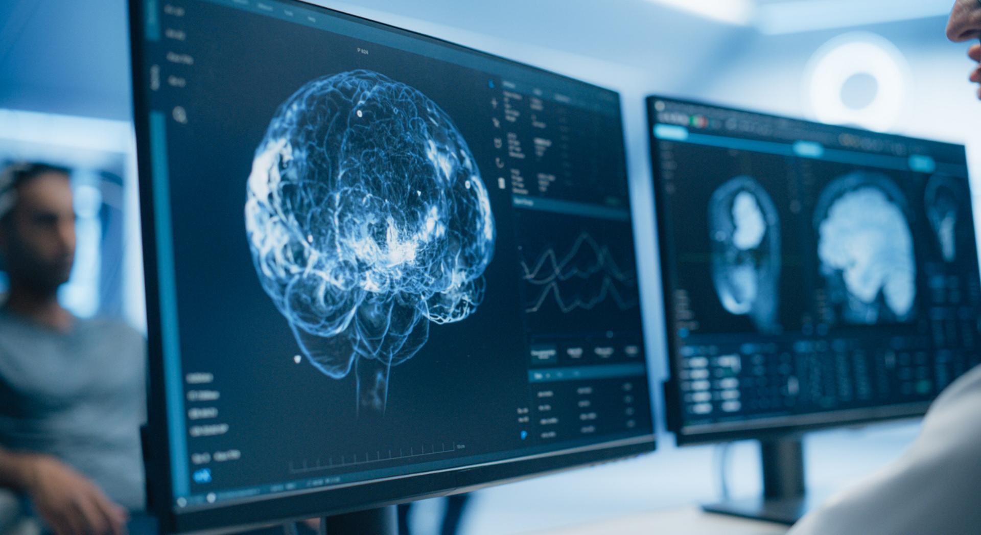 Voici pourquoi peu d'espèces auraient intérêt à développer l'intelligence selon un neuroscientifique