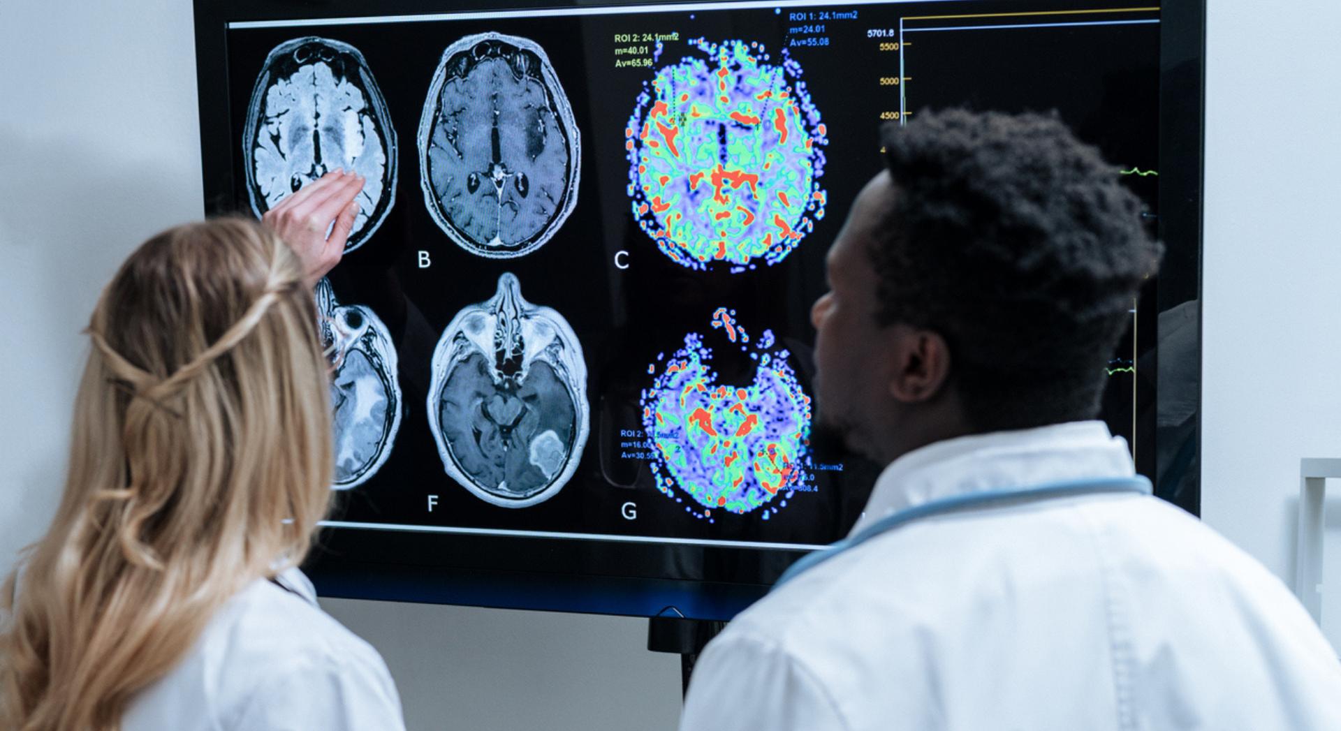 Alzheimer : un simple test de 10 minutes pourrait repérer la maladie jusqu'à 15 ans avant les premiers signes