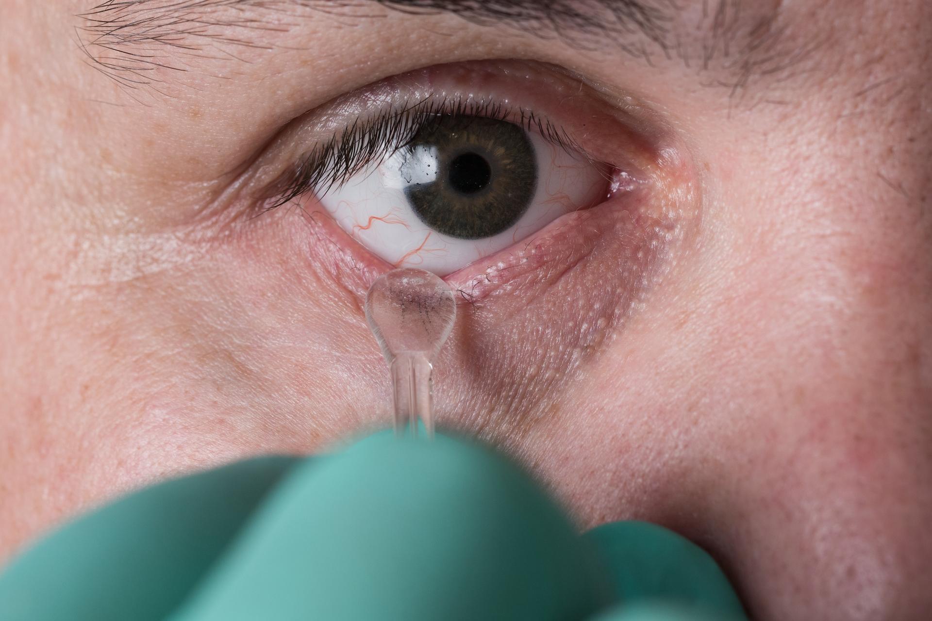 Patient bizarre : il recouvre la vue après qu’on lui a greffé un morceau de sa mâchoire dans l'œil