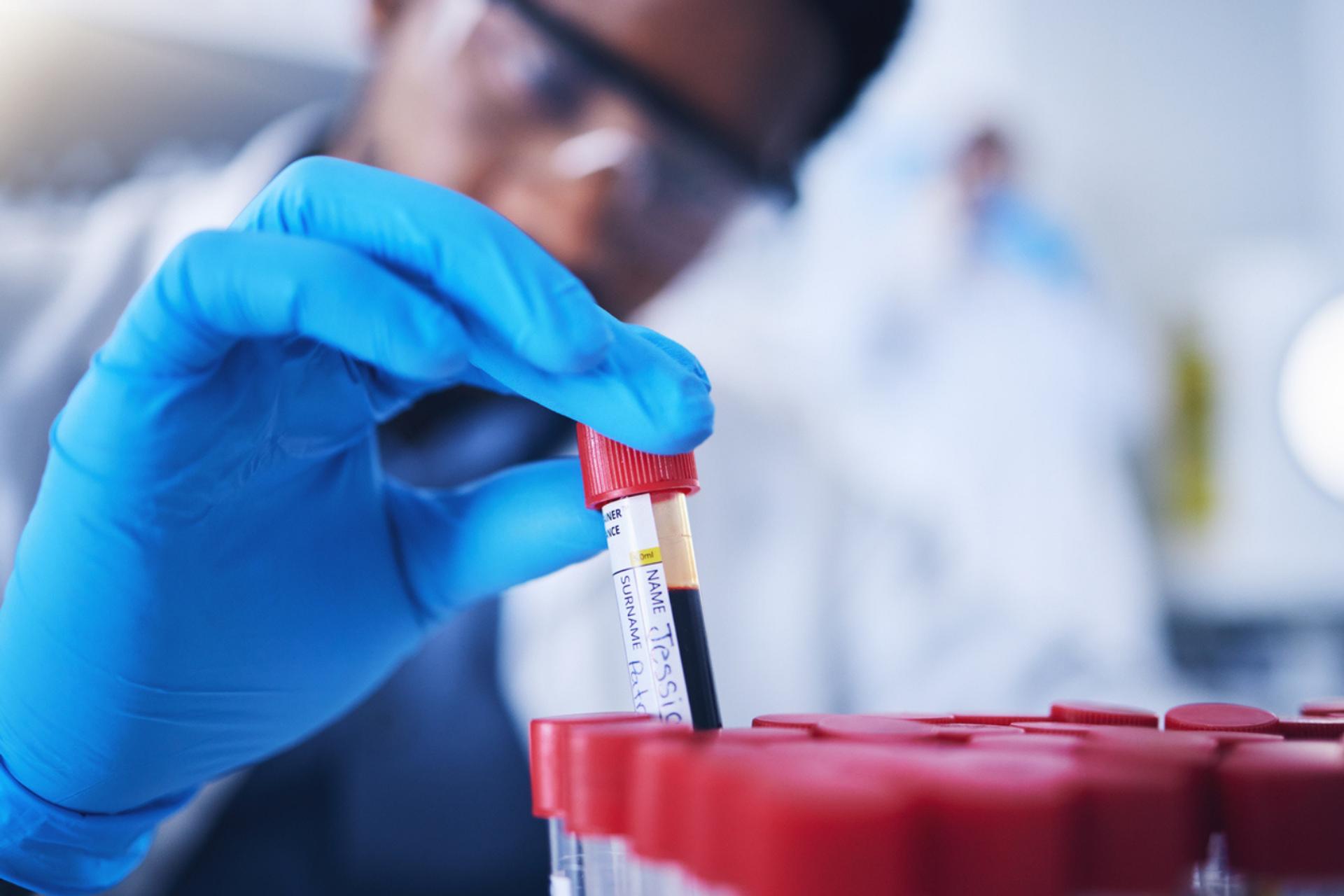 Un simple test sanguin pourrait prédire votre risque cardiaque 30 ans à l'avance