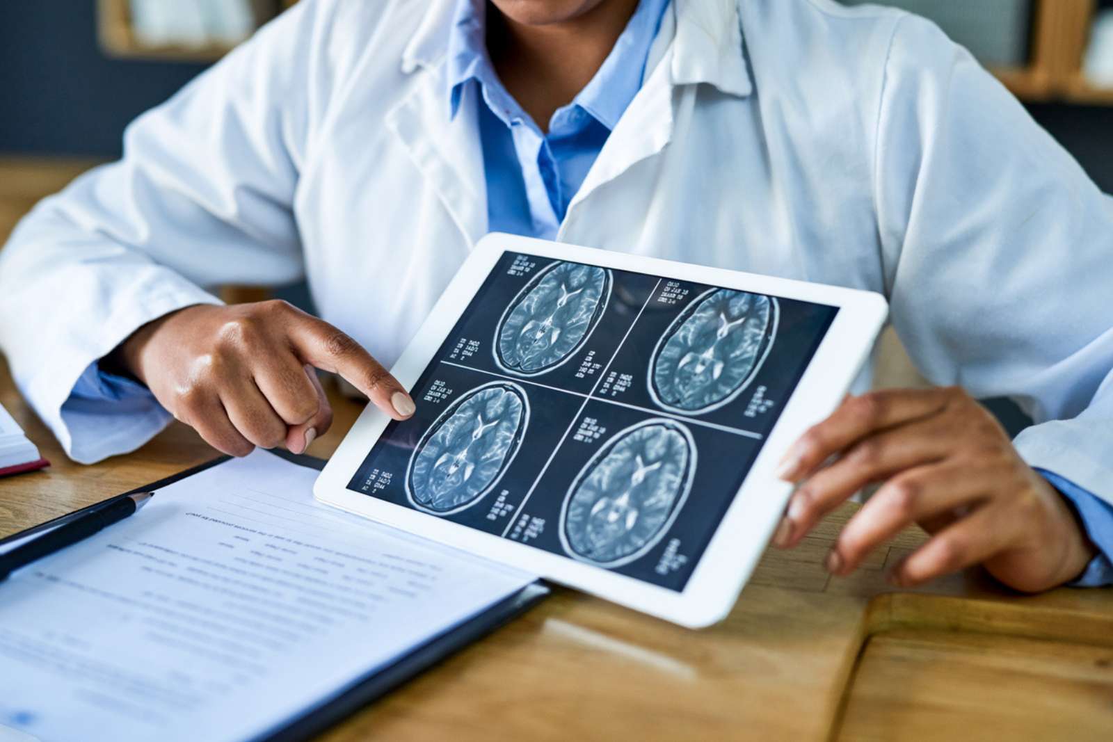 Diagnostiqué Alzheimer à 19 ans : ce cas défie tout ce que l’on croyait savoir