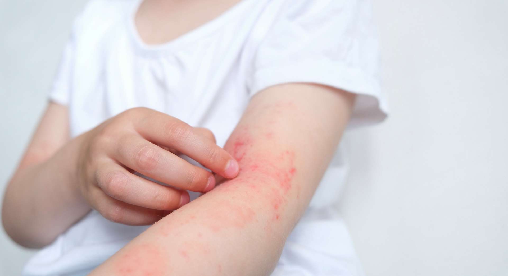 Vous n’allez pas en revenir : ces allergies improbables existent bel et bien