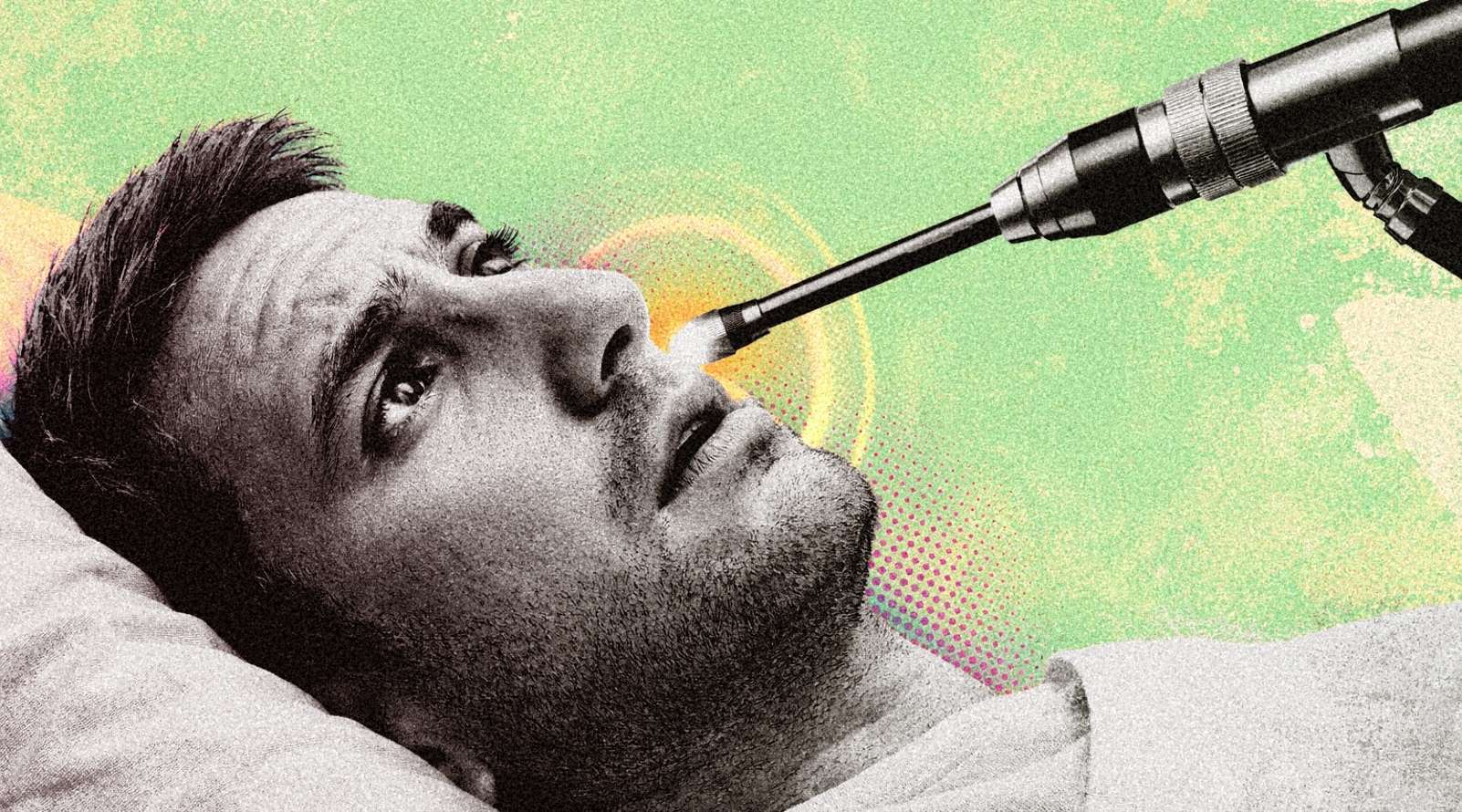 Patient bizarre : il saignait du nez depuis 20 jours, ce que les médecins ont trouvé dans son nez les a sidéré