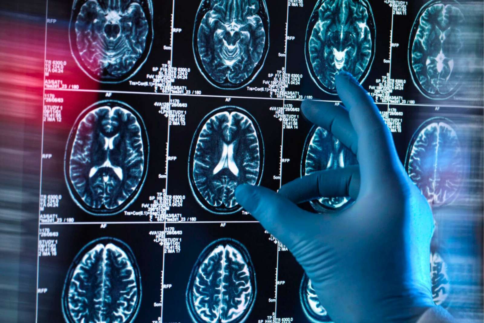 Et si la meilleure arme contre Alzheimer était bien plus simple qu’on ne le pensait ?