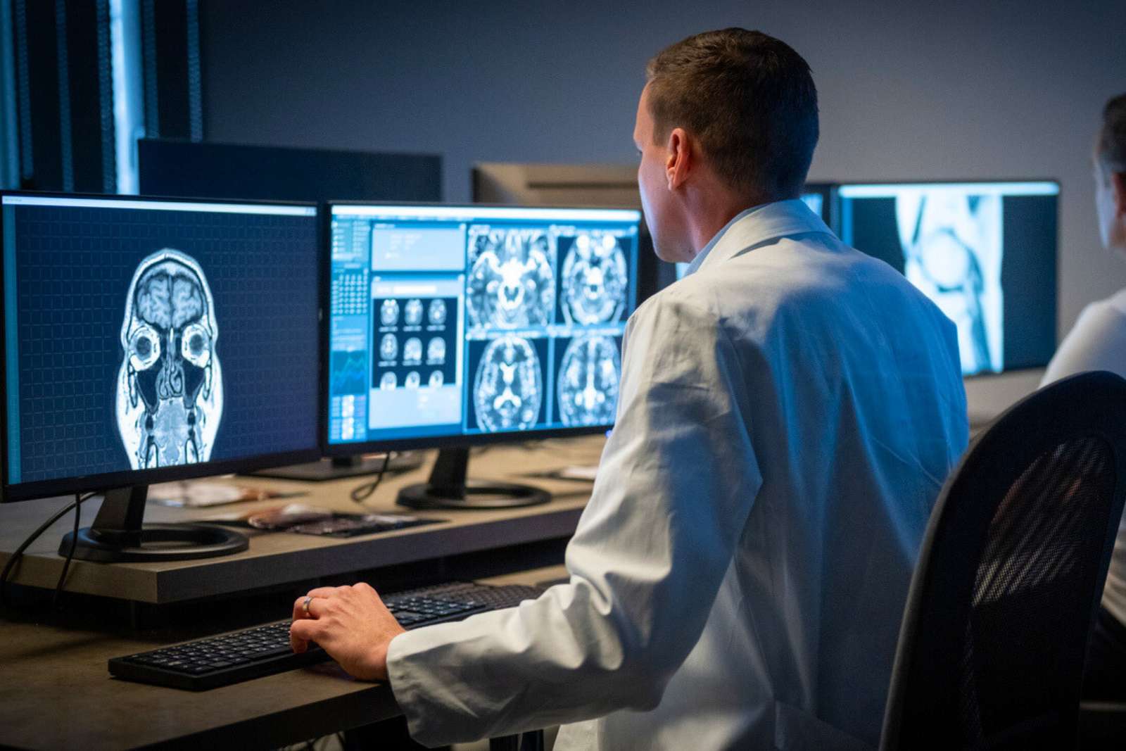 Alzheimer : un nouvel algorithme améliore la détection précoce du risque