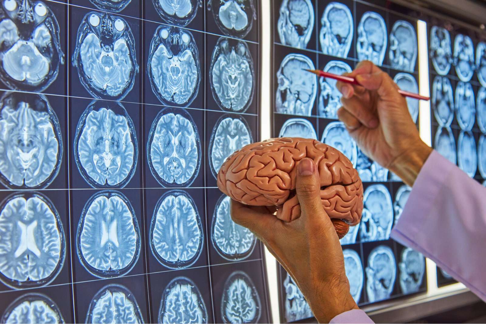 Alzheimer : un élément clé du cerveau était négligé… jusqu’à aujourd’hui