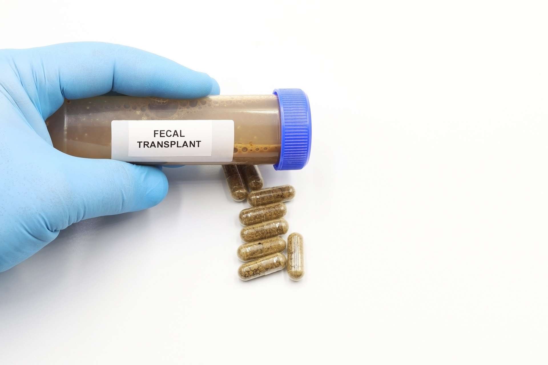 « Pilules de selles » et cancer : la transplantation de microbiote fécal donne des résultats inattendus pour les traitements