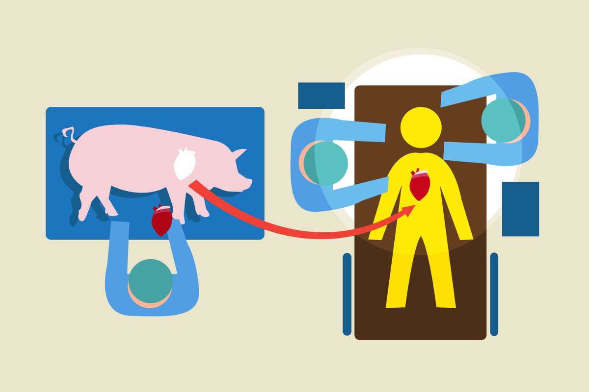 On peut greffer des organes de porc chez l’humain… mais pas créer des organes humains dans des porcs : ce paradoxe interroge