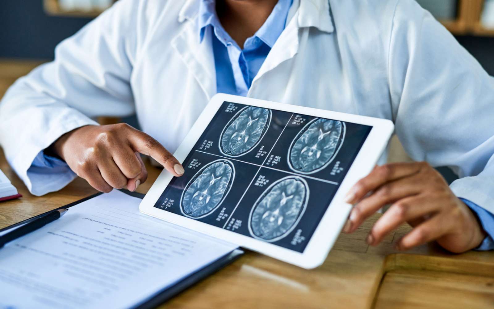 Diagnostiqué Alzheimer à 19 ans : ce cas défie tout ce que l’on croyait savoir