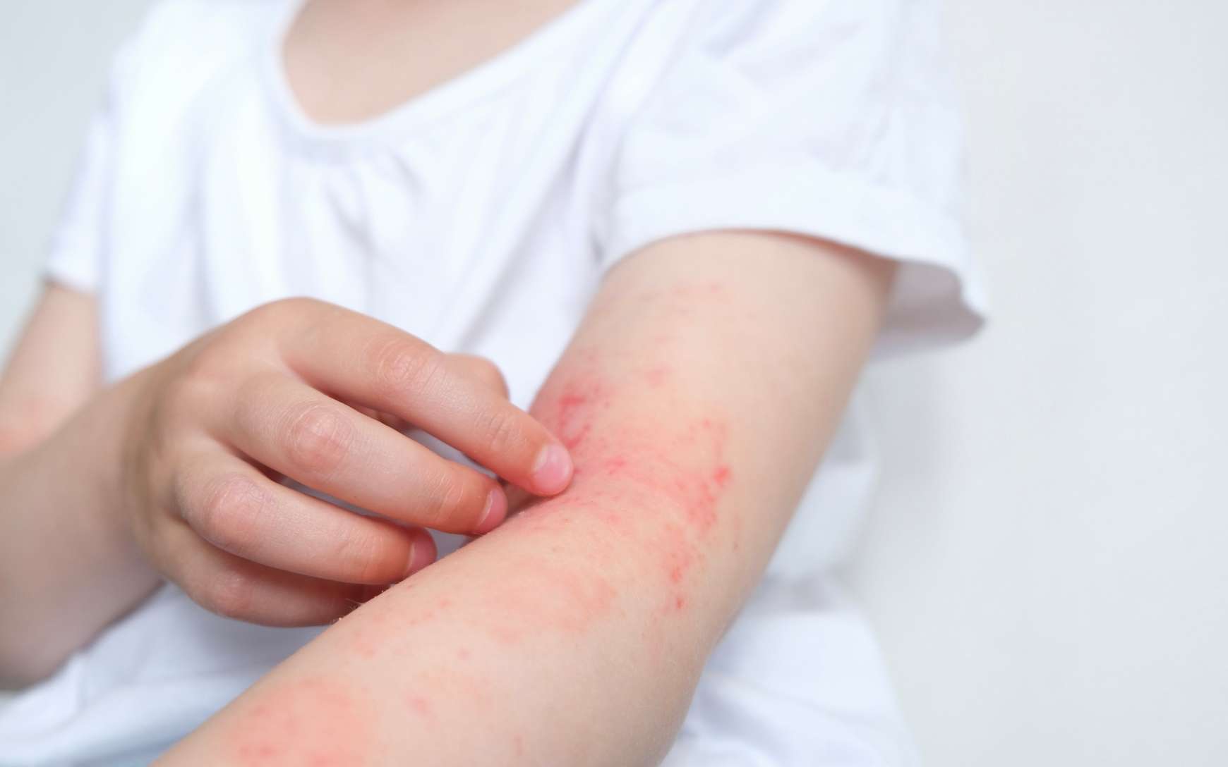 Vous n’allez pas en revenir : ces allergies improbables existent bel et bien