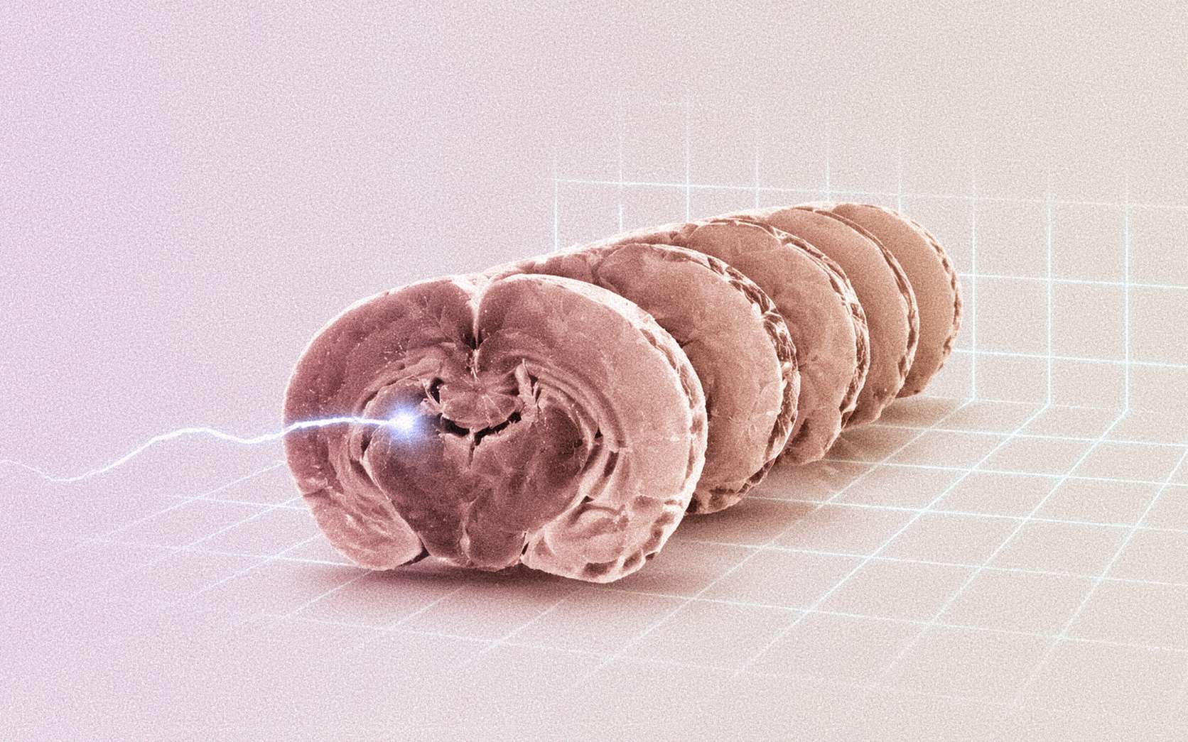 Des chercheurs ont fait redémarrer un cerveau de souris congelé : l'histoire est vertigineuse !