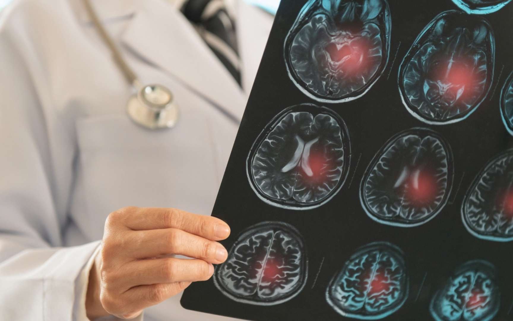 Présenté comme sans danger, cet édulcorant connu inquiète les chercheurs