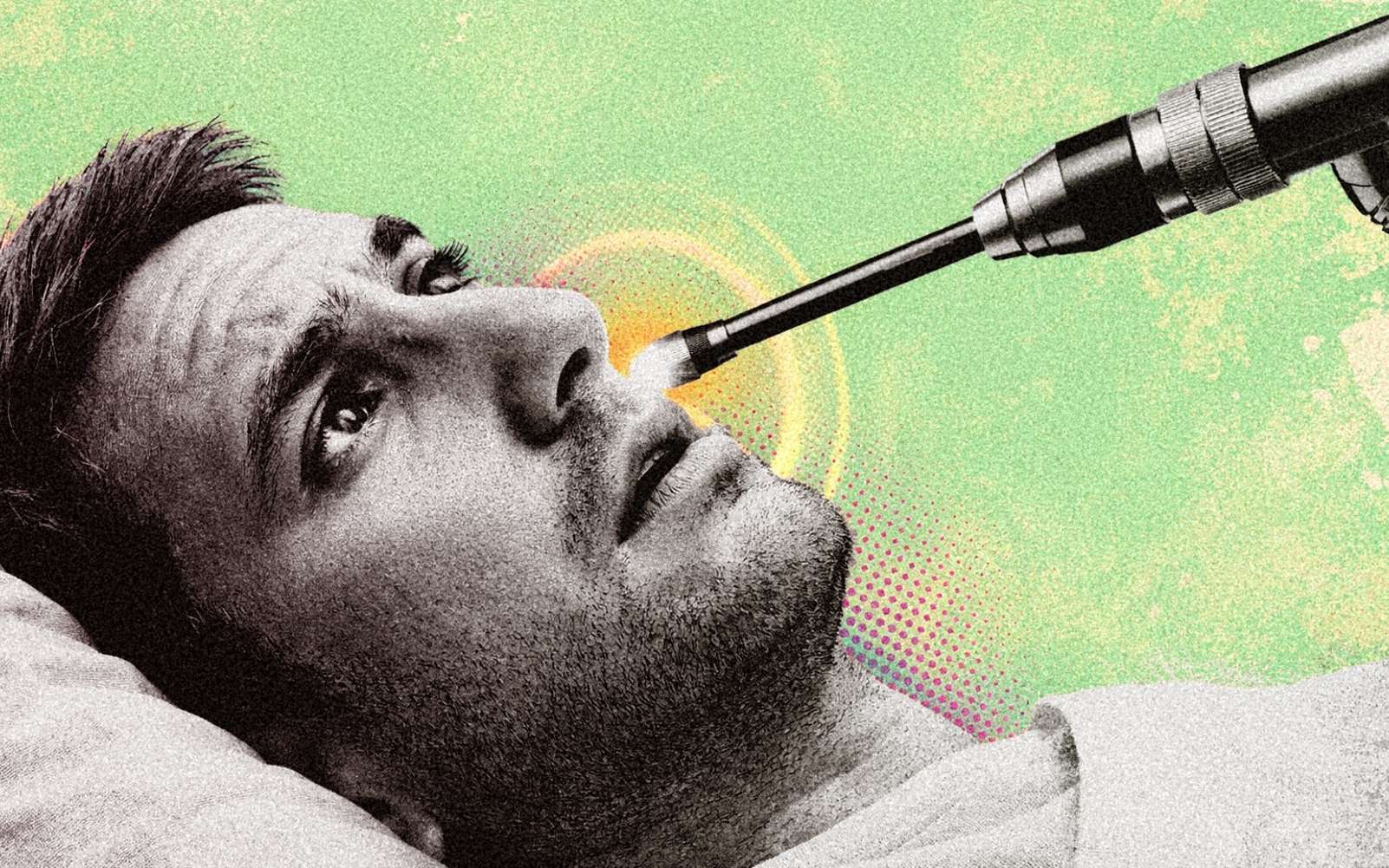 Patient bizarre : il saignait du nez depuis 20 jours, ce que les médecins ont trouvé dans son nez les a sidéré