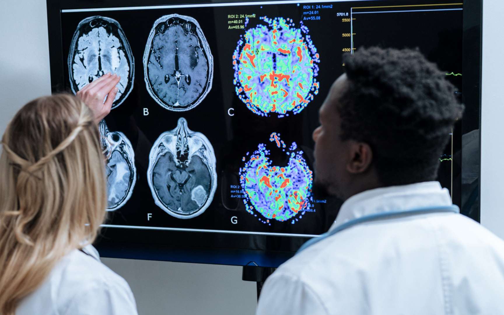 Alzheimer : un simple test de 10 minutes pourrait repérer la maladie jusqu'à 15 ans avant les premiers signes