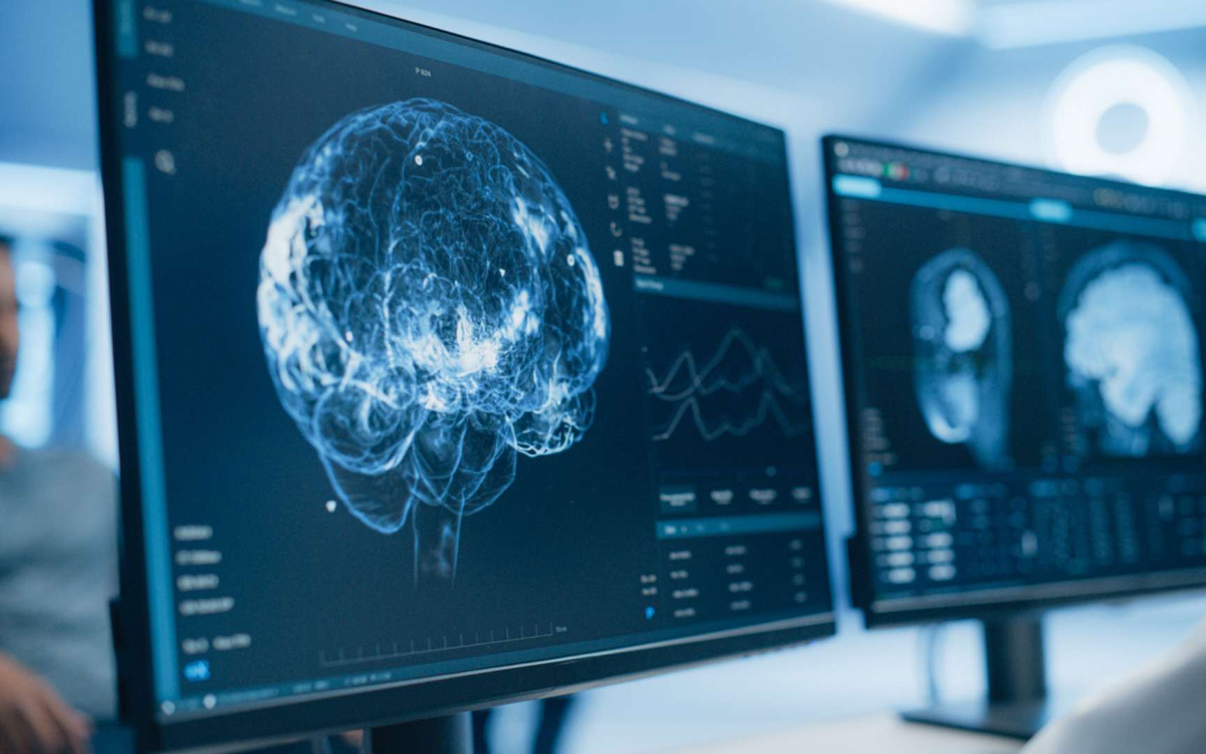 Voici pourquoi peu d'espèces auraient intérêt à développer l'intelligence selon un neuroscientifique
