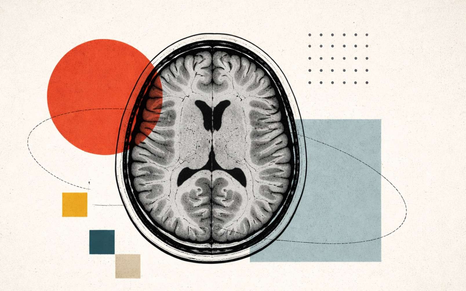 Une IA réussit à lire seule le cerveau et à prédire les maladies et le taux de survie au cancer sans annotation des médecins