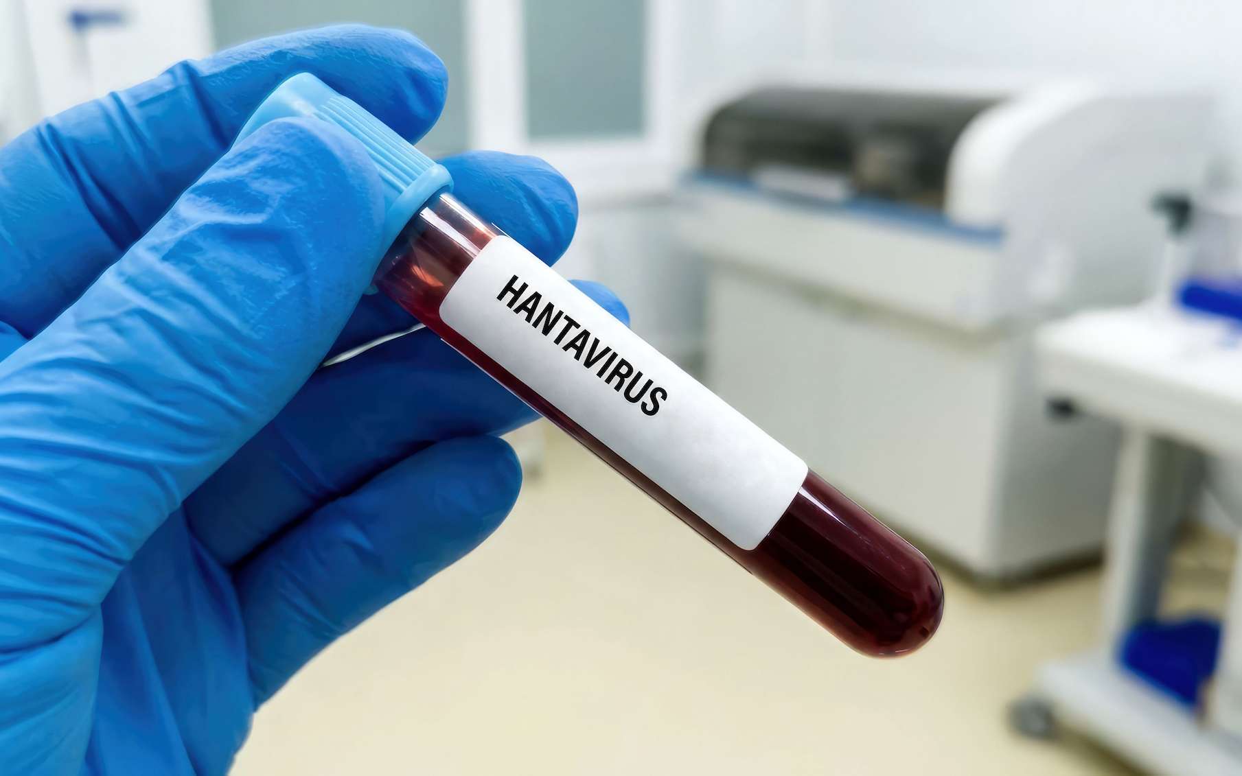 Hantavirus : le virus Andes du MV Hondius était-il devenu mutant ? Le verdict vient de tomber