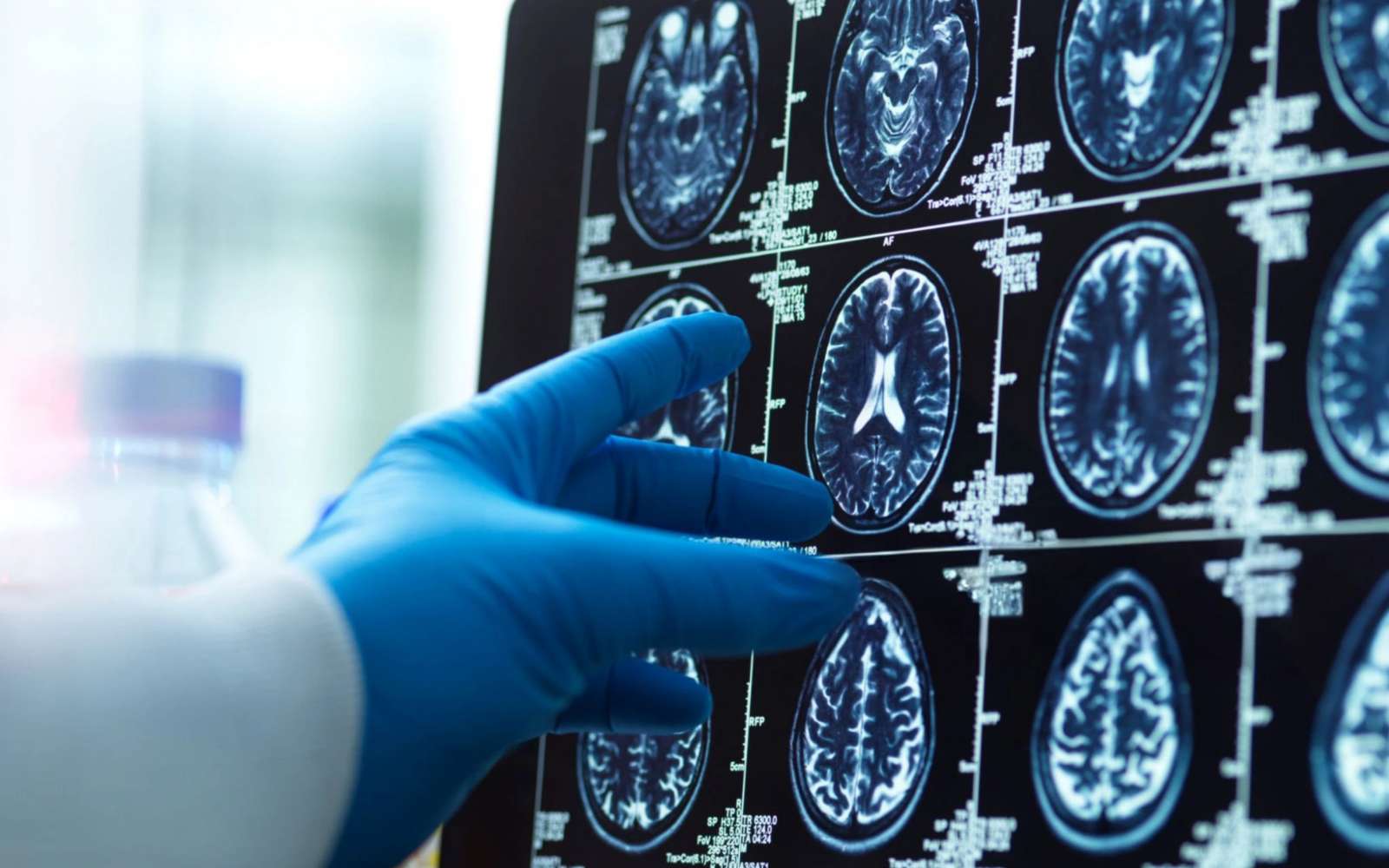 Cette substance vient d'être détectée en grande quantité dans des cerveaux humains et les chercheurs s'alarment