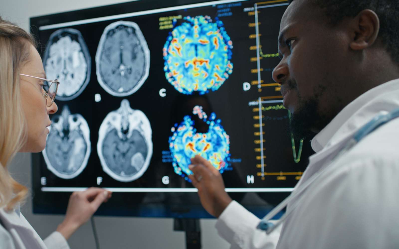 Ils veulent ralentir le vieillissement cérébral : ces nutriments changent tout