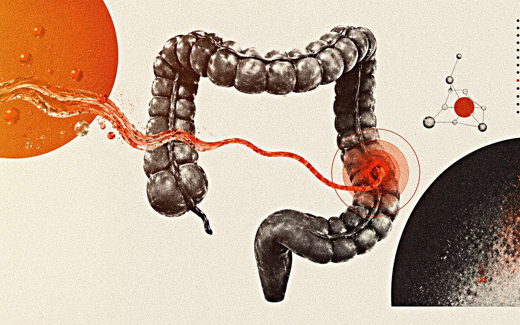 Cancer colorectal chez les moins de 50 ans : un herbicide présent dans l'eau ressort dans une étude majeure
