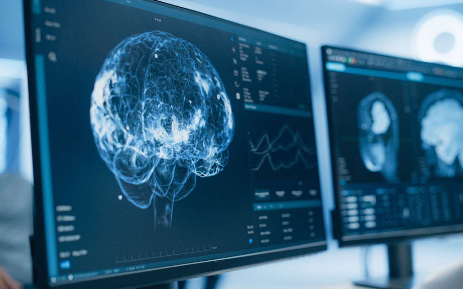 Alzheimer : ce dérèglement nocturne caché commence bien avant les pertes de mémoire