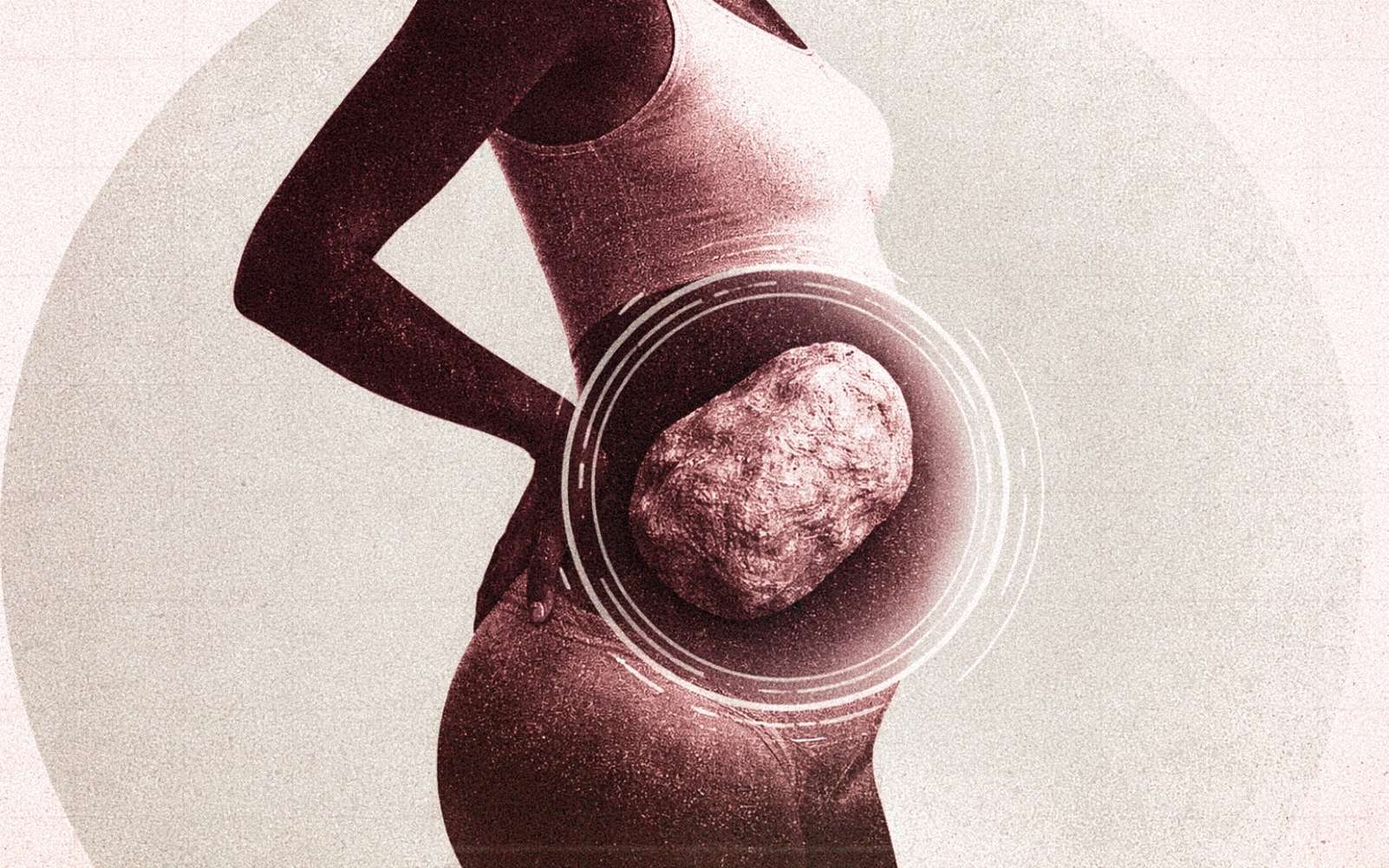 Patient bizarre : décédée après un coup subi au ventre, l’autopsie révèle une surprise dans son abdomen