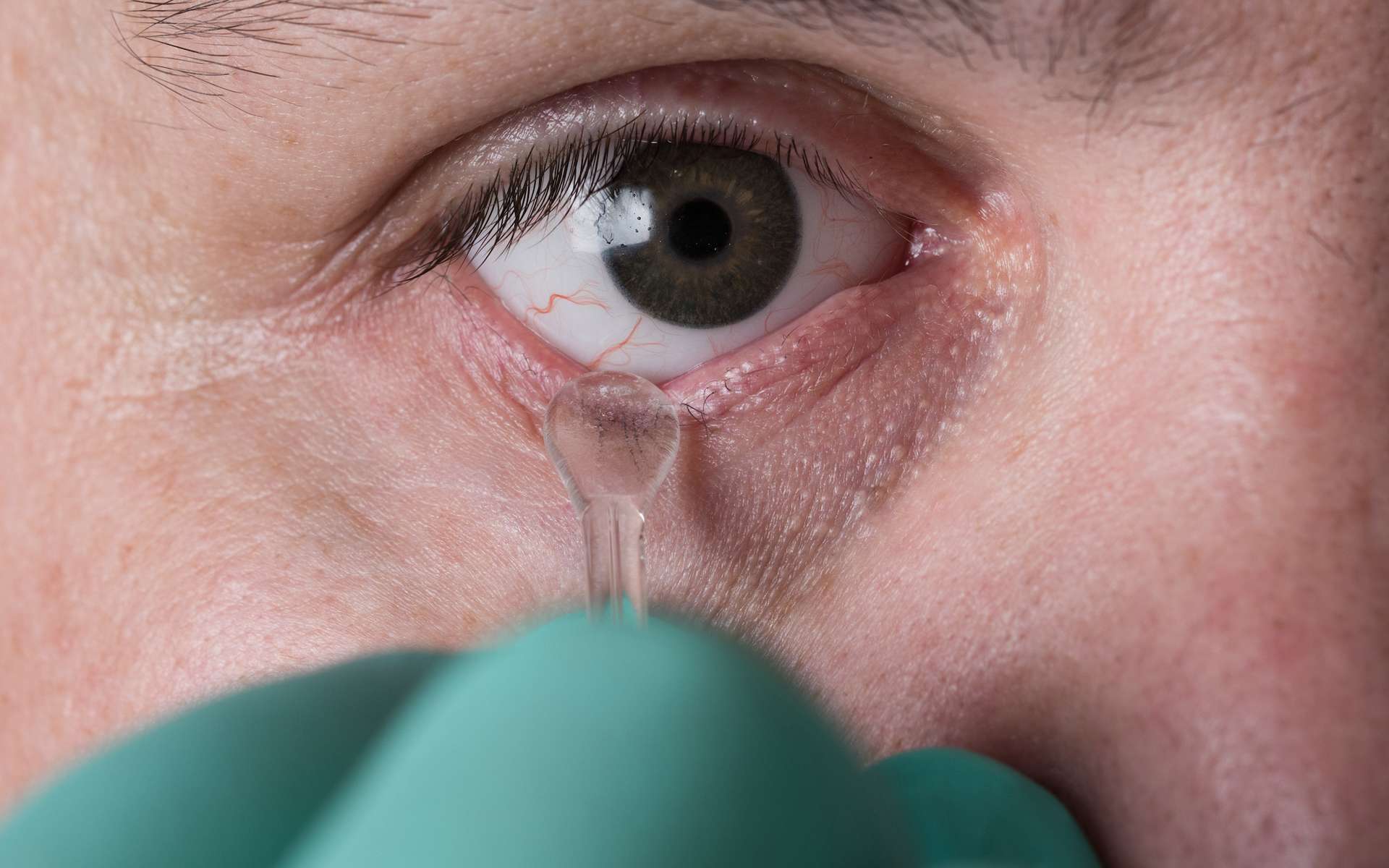 Patient bizarre : il recouvre la vue après qu’on lui a greffé un morceau de sa mâchoire dans l'œil