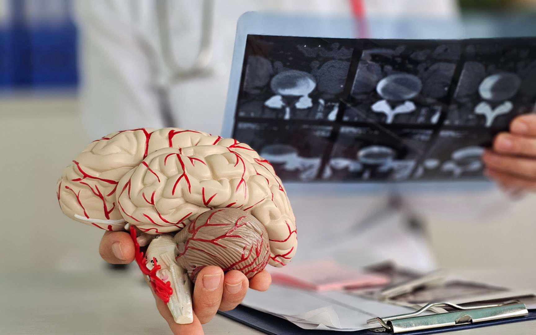 Alzheimer : des scientifiques découvrent un mystérieux « germe » qui pourrait jouer un rôle clé dans la maladie