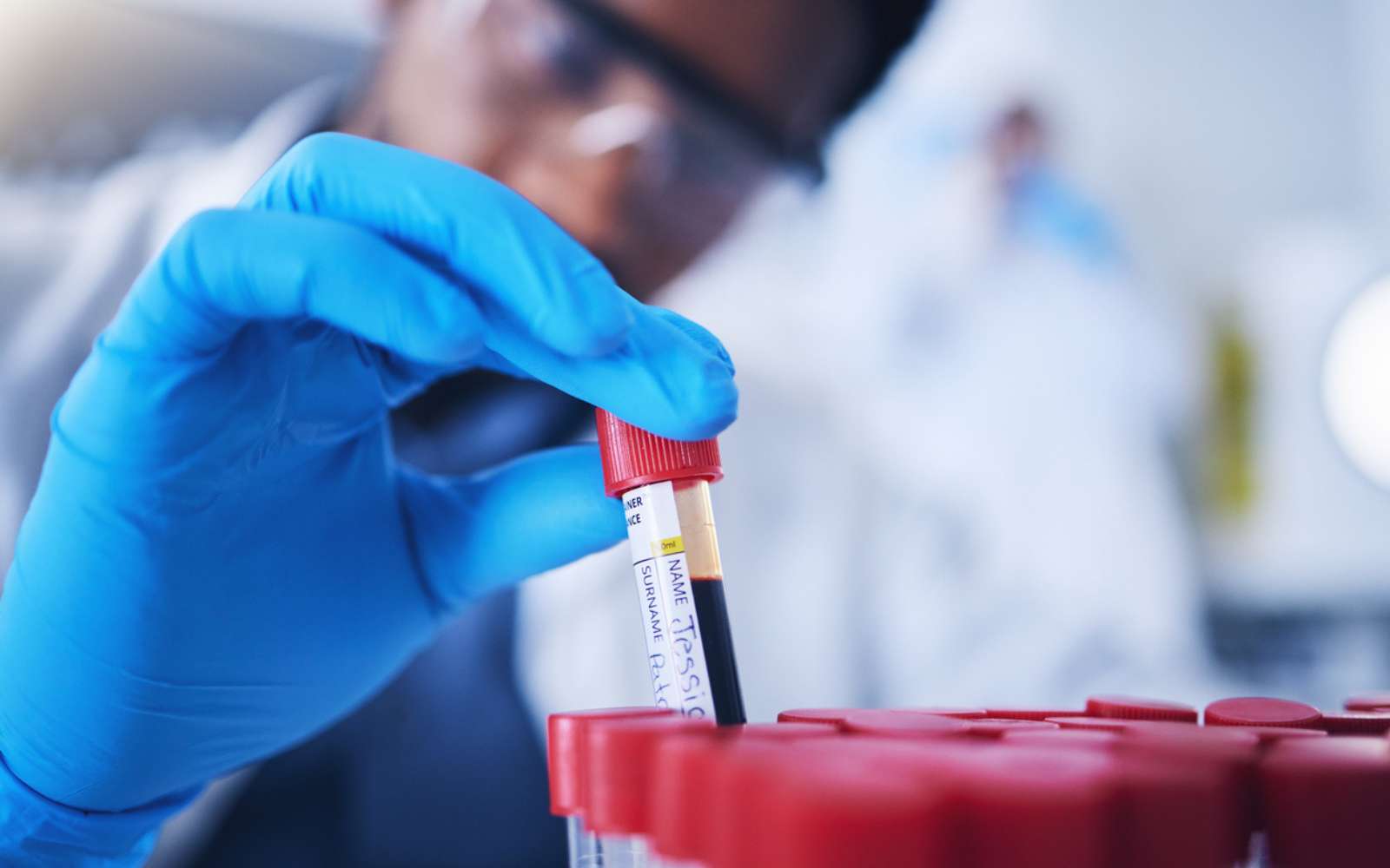 Un simple test sanguin pourrait prédire votre risque cardiaque 30 ans à l'avance