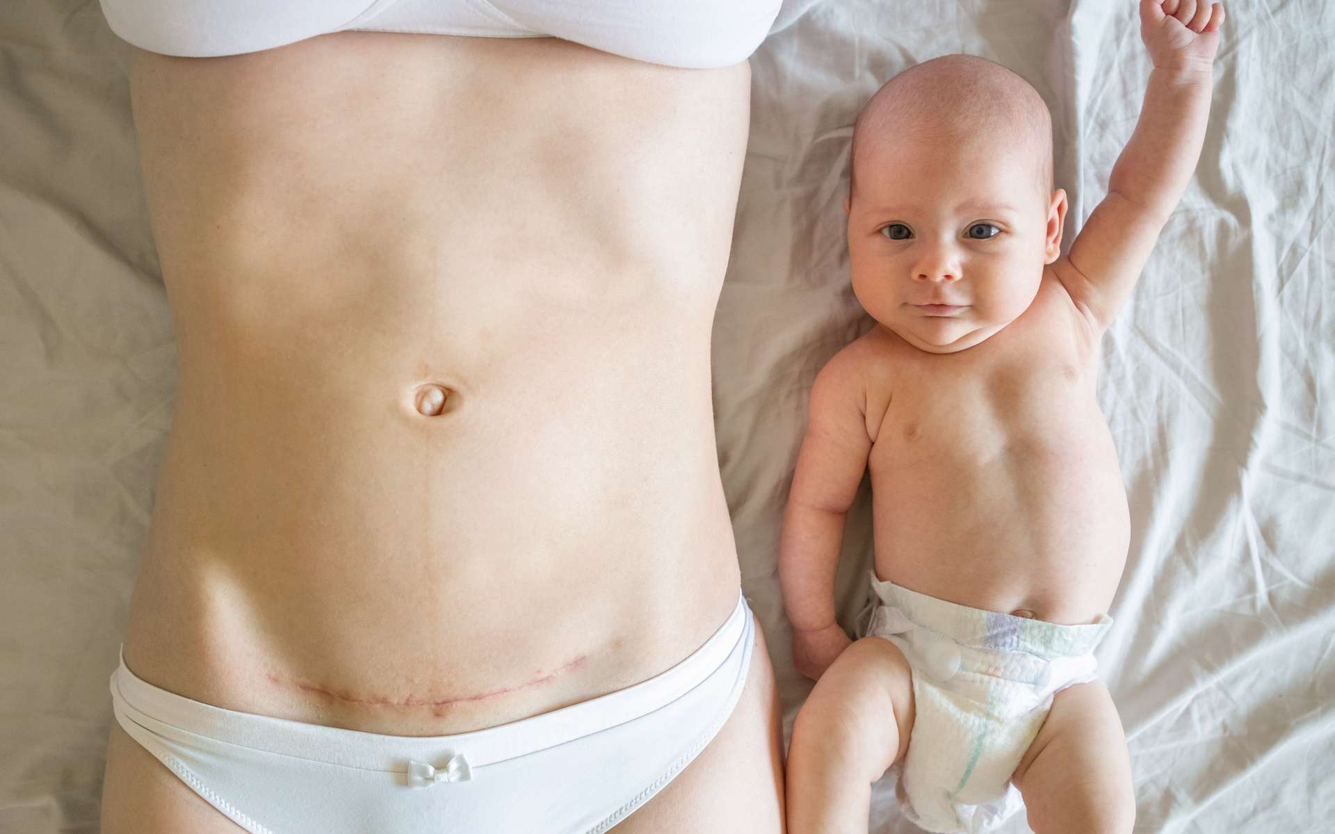 Césarienne : comment le sexe du bébé influence ses risques de maladies à long terme