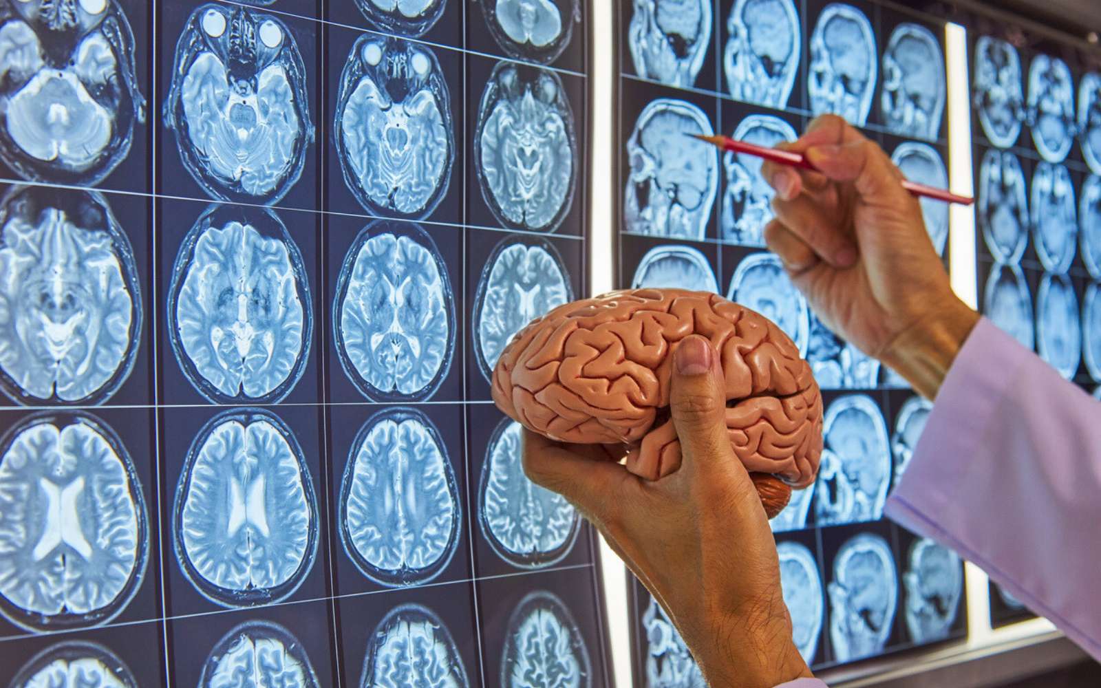 Alzheimer : un élément clé du cerveau était négligé… jusqu’à aujourd’hui