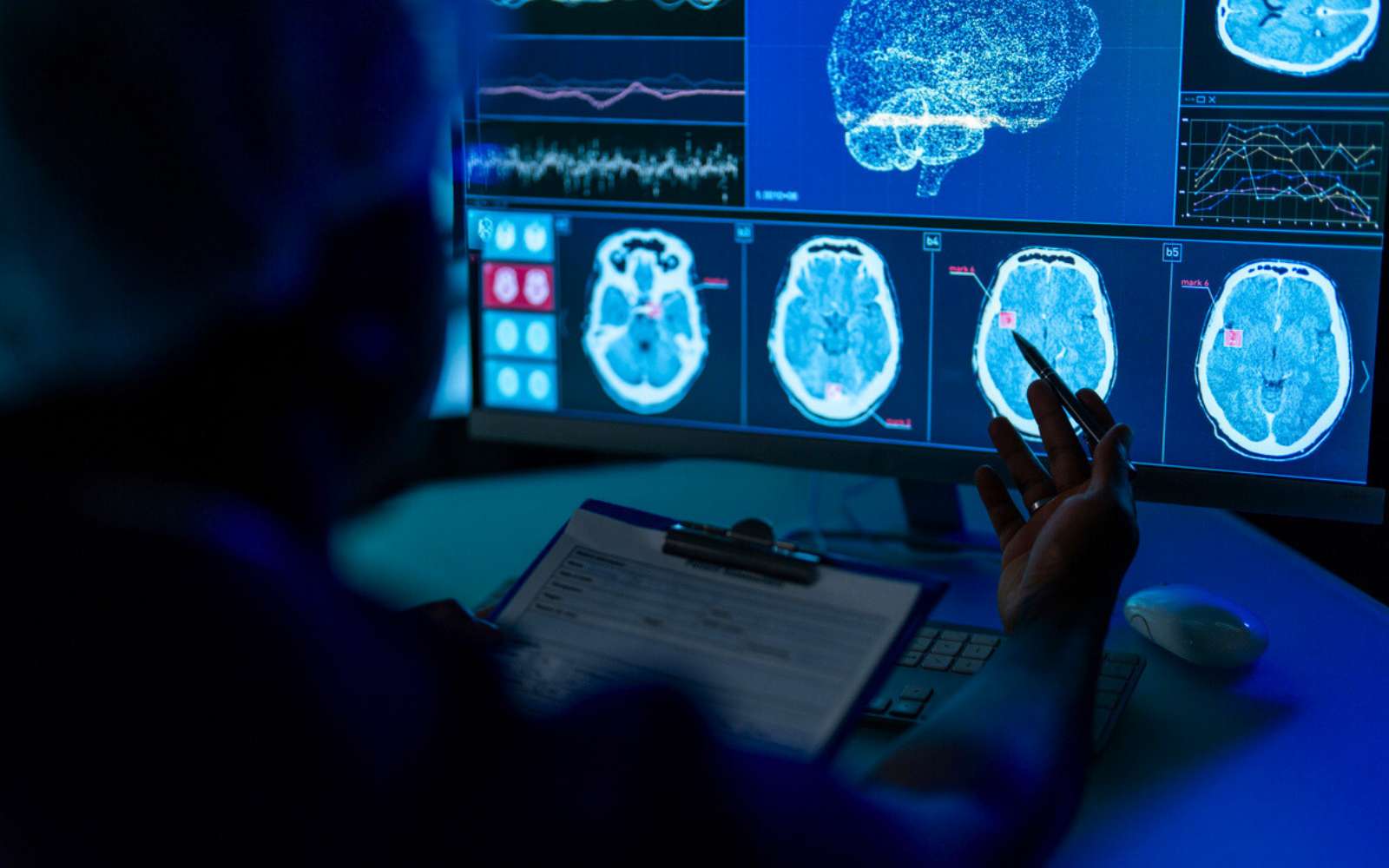 Cette anomalie dans le cerveau pourrait faire le lien entre TDAH et Alzheimer