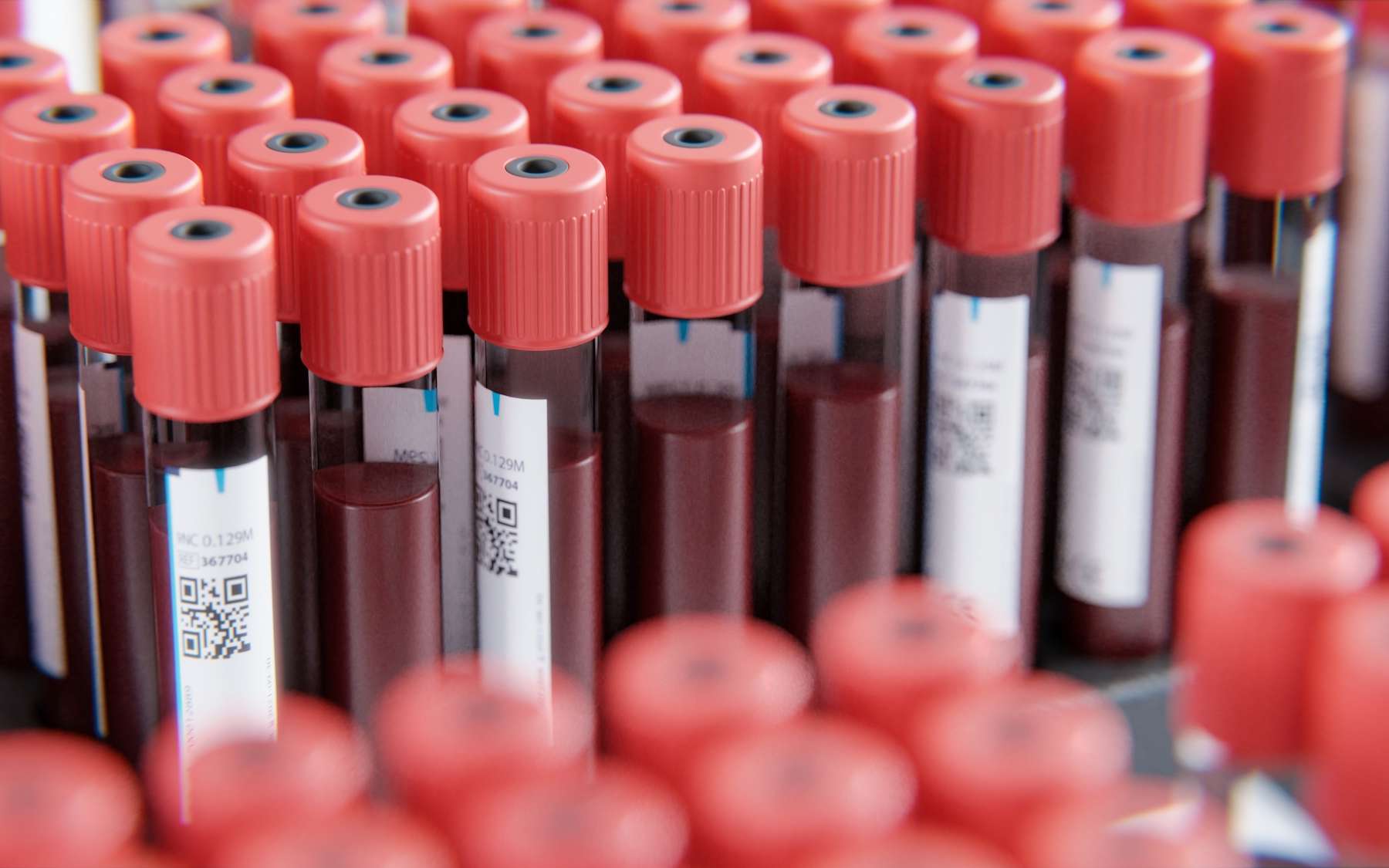 Le taux de CO2 atmosphérique ne réchauffe pas seulement la planète, c'est aussi un problème pour votre corps...