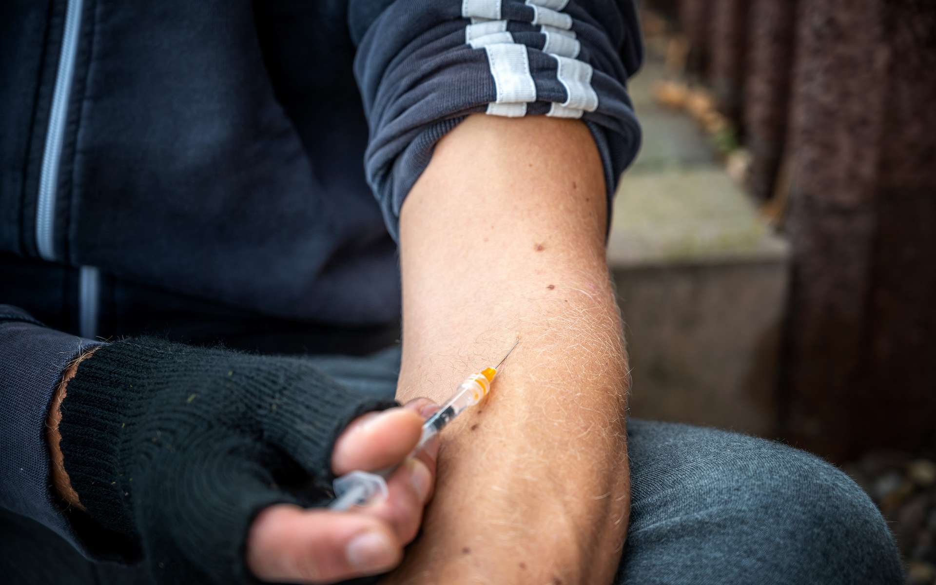 Patient bizarre : il s'injecte sa propre semence dans le bras pendant 18 mois pour traiter son mal de dos !