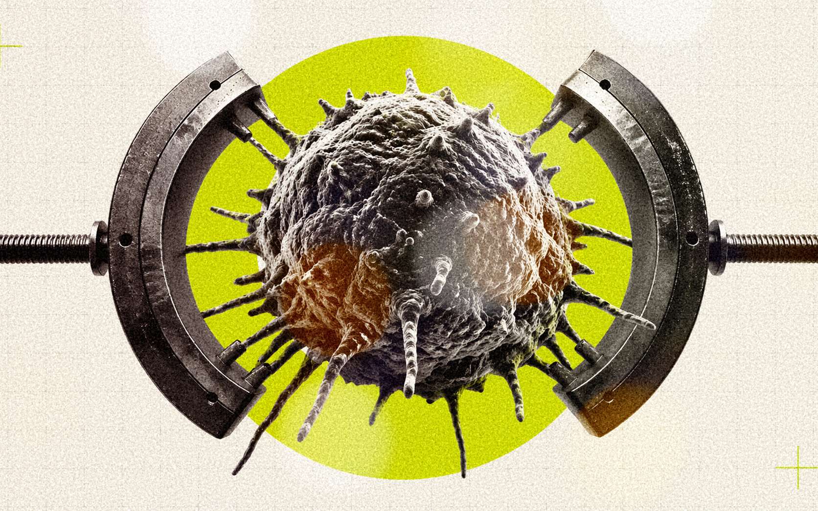 Cancer : des chercheurs ont mis au point un piège qui se referme sur la tumeur au moment où elle résiste