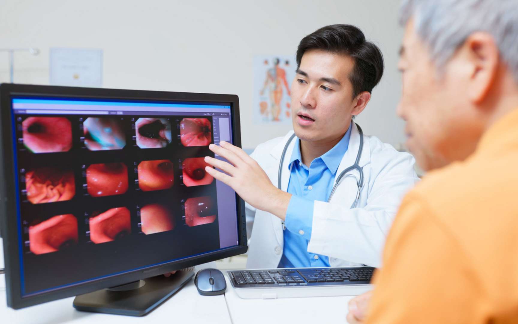 Cancer de l'estomac : les scientifiques alertent sur une bactérie très répandue mais souvent ignorée