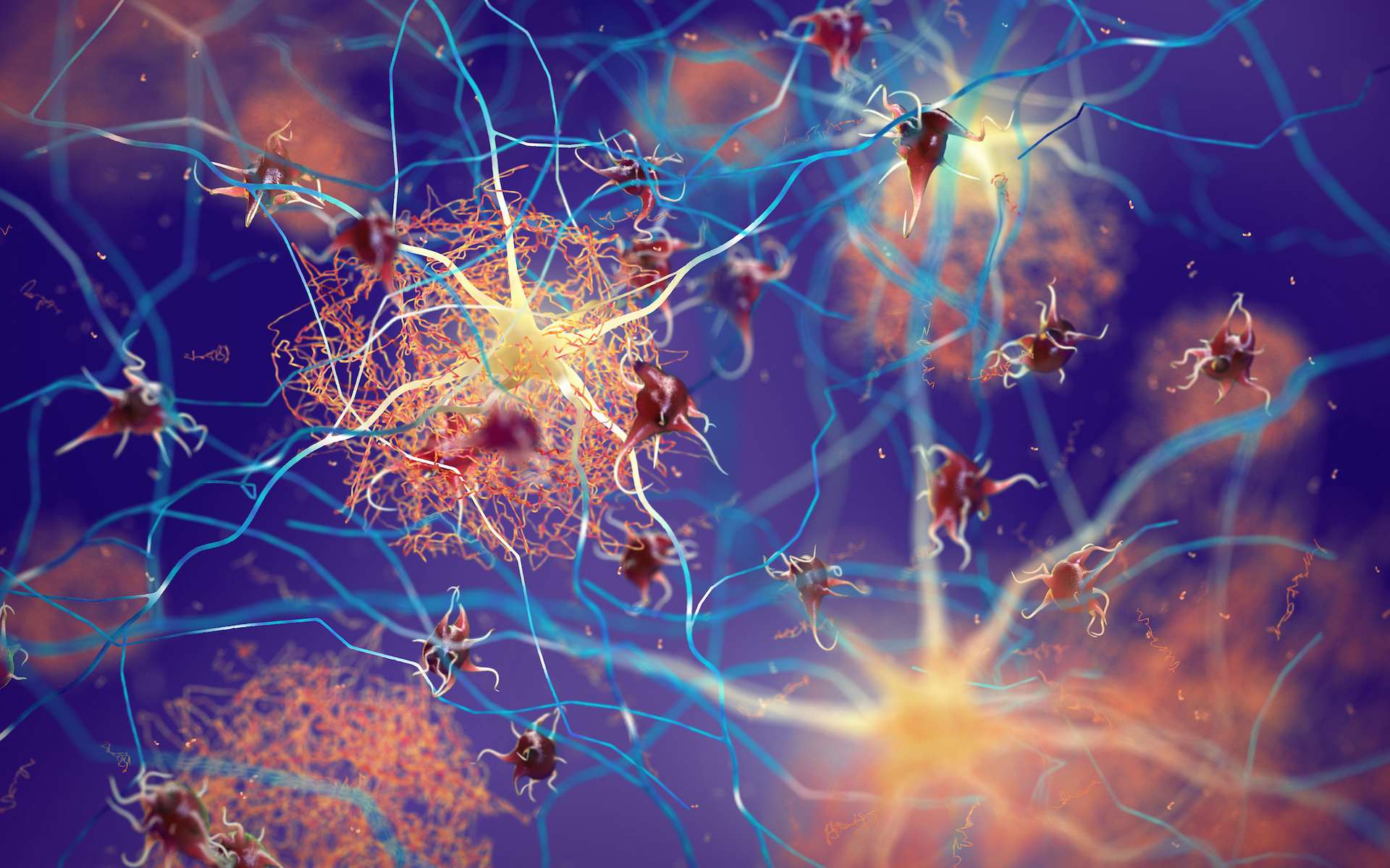 Les personnes qui ont eu un cancer auraient moins de risque de développer Alzheimer et on sait désormais pourquoi